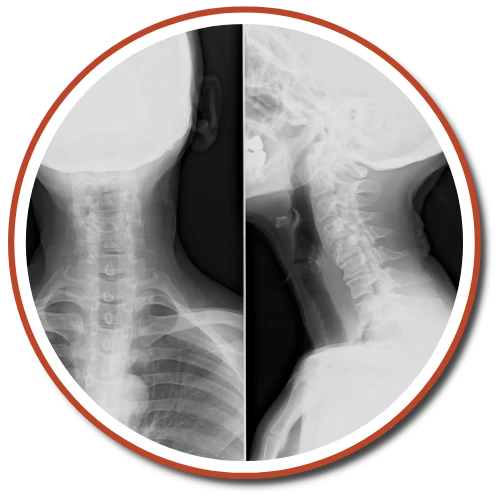 Gonstead X-rays 1